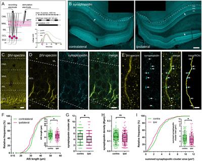 Structural plasticity of the axon initial segment in rat hippocampal granule cells following high frequency stimulation and LTP induction